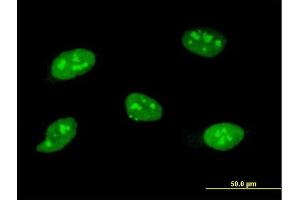 SOCS3 antibody  (AA 1-225)