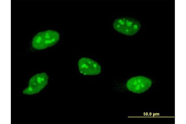 SOCS3 antibody  (AA 1-225)