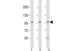 Western blot testing of human 1) HepG2, 2) PC-3 and 3) U-87 MG cell lysate with PCDH10 antibody at 1:2000. (PCDH10 antibody  (AA 128-160))