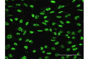 Immunofluorescence of monoclonal antibody to PLAG1 on HeLa cell. (PLAG1 antibody  (AA 2-99))