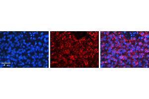 PSEN2 antibody - N-terminal region          Formalin Fixed Paraffin Embedded Tissue:  Human Pineal Tissue    Observed Staining:  Cytoplasm in Human Pineal Tissue   Primary Antibody Concentration:  1:100    Other Working Concentrations:  1/600    Secondary Antibody:  Donkey anti-Rabbit-Cy3    Secondary Antibody Concentration:  1:200    Magnification:  20X    Exposure Time:  0. (Presenilin 2 antibody  (N-Term))