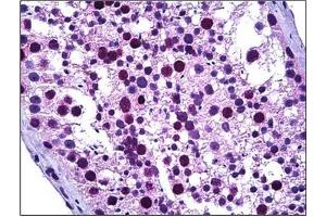 Human Testis: Formalin-Fixed, Paraffin-Embedded (FFPE) (TPX2 antibody  (Internal Region))