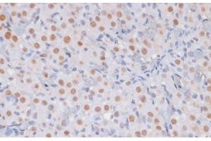 Immunohistochemistry of paraffin-embedded Rat ovary using TriMethyl-Histone H3-K27 Polyclonal Antibody at dilution of 1:100 (40x lens). (Histone 3 antibody  (3meLys27))
