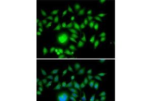 Immunofluorescence analysis of MCF7 cells using ATOH1 Polyclonal Antibody (ATOH1 antibody)
