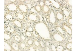 ABIN6265131 and ABIN6277621 at 1/100 staining human normal kidney tissue by IHC-P. (SLC3A1 antibody  (C-Term))