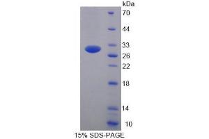 SDS-PAGE (SDS) image for Insulin-Like Growth Factor Binding Protein 1 (IGFBPI) (AA 36-235) protein (His tag) (ABIN2125292) (IGFBPI Protein (AA 36-235) (His tag))