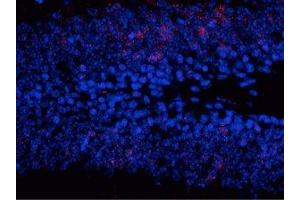 Immunostaining of granule cells in the dentate gyrus of saline treated mouse showing (MAPK1/2 (pThr202), (pTyr204) antibody)