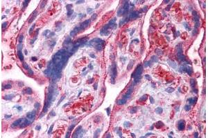 Human Placenta: Formalin-Fixed, Paraffin-Embedded (FFPE) (UCHL3 antibody  (N-Term))