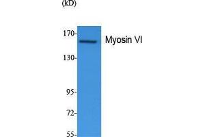 Western Blotting (WB) image for anti-Myosin VI (MYO6) (N-Term) antibody (ABIN3178103) (Myosin VI antibody  (N-Term))
