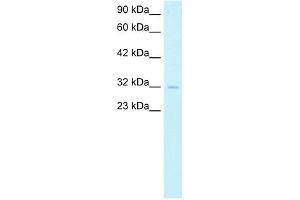 WB Suggested Anti-SIRT5 Antibody Titration:  1. (SIRT5 antibody  (Middle Region))