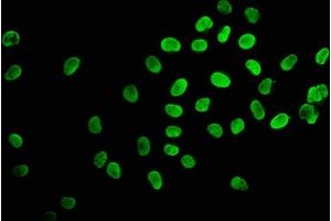 Immunofluorescence staining of Hela cells (treated with 30mM sodium butyrate for 4h) with ABIN7139155 at 1:2. (Histone H2B antibody  (acLys120))