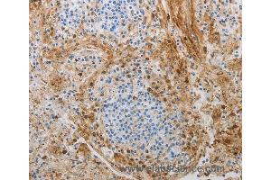 Immunohistochemistry of Human tonsil using NGFR Polyclonal Antibody at dilution of 1:50