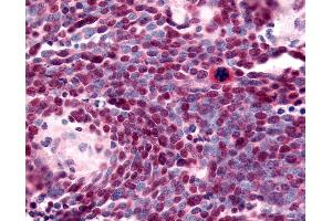 Immunohistochemistry (IHC) image for anti-Nuclear Receptor Subfamily 2, Group E, Member 1 (NR2E1) (N-Term) antibody (ABIN1049135)