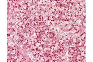 Human Adrenal: Formalin-Fixed, Paraffin-Embedded (FFPE). (ASAH1 antibody  (N-Term))