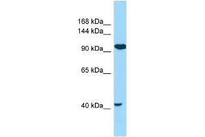 WB Suggested Anti-CILP2 Antibody Titration: 1. (Cilp2 antibody  (N-Term))
