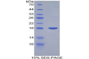 SDS-PAGE analysis of Rat BMP15 Protein.