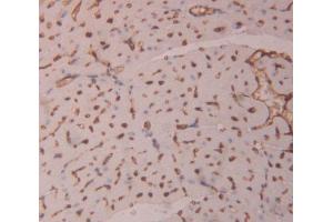 Used in DAB staining on fromalin fixed paraffin- embedded heart tissue (HIPK1 antibody  (AA 1-290))