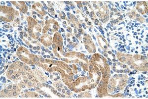 Human kidney (CHAF1B antibody  (C-Term))