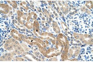 Human kidney (CHAF1B antibody  (C-Term))