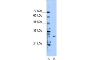 WB Suggested Anti-METTL1 Antibody Titration:  2. (METTL1 antibody  (Middle Region))