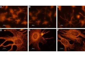 Expression of CNGA2 in rat cerebellum primary culture  - Immunocytochemical staining of paraformaldehyde-fixed and permeabilized rat cerebellum primary culture. (CNGA2 antibody  (Intracellular))