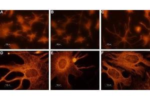 Expression of CNGA2 in rat cerebellum primary culture  - Immunocytochemical staining of paraformaldehyde-fixed and permeabilized rat cerebellum primary culture. (CNGA2 antibody  (C-Term, Intracellular))