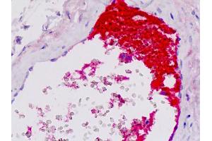 Anti-Complement C4c antibody IHC staining of human vessel. (Complement C4c antibody)
