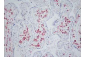 Image no. 3 for anti-CD163 (CD163) antibody (ABIN379967) (CD163 antibody)