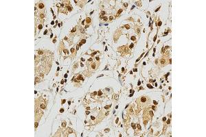 Immunohistochemistry (IHC) image for anti-Nuclear Factor of Activated T-Cells, Cytoplasmic, Calcineurin-Dependent 1 (NFATC1) (AA 20-300) antibody (ABIN3022101)