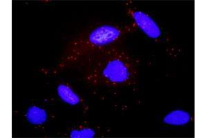 Proximity Ligation Analysis of protein-protein interactions between GNAS and ADCY2. (ADCY2 antibody  (AA 977-1086))