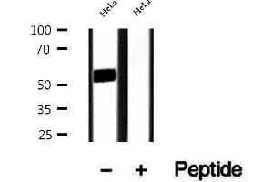 Western blot analysis of extracts of HeLa cells, using DMAP1 antibody.