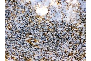 Anti- TGM2 Picoband antibody, IHC(F) IHC(F): Rat Spleen Tissue (Transglutaminase 2 antibody  (N-Term))
