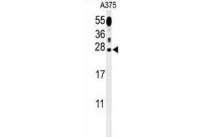 Western Blotting (WB) image for anti-Inosine Triphosphatase (ITPA) antibody (ABIN3002176) (ITPA antibody)