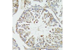 Immunohistochemistry of paraffin-embedded mouse testis using HSP70/HSP antibody (2948) at dilution of 1:100 (40x lens). (HSP70 1A antibody  (AA 500-600))
