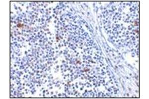 Immunohistochemistry of MDA5 in human lymph node tissue with MDA5 antibody at 5 μg/ml. (IFIH1 antibody  (Center))