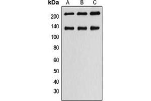 Western blot analysis of MLCK1 expression in HeLa (A), SP2/0 (B), H9C2 (C) whole cell lysates.