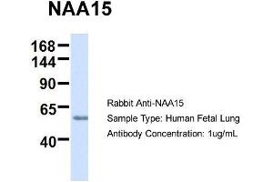 Host:  Rabbit  Target Name:  NAA15  Sample Type:  Human Fetal Lung  Antibody Dilution:  1. (NAA15 antibody  (N-Term))