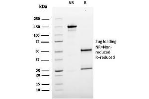 SDS-PAGE Analysis Purified MCAM Mouse Monoclonal Antibody (MCAM/3179). (MCAM antibody)