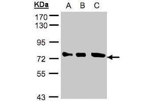 WB Image Sample(30 ug whole cell lysate) A:A431, B:H1299 C:Hep G2 , 10% SDS PAGE antibody diluted at 1:2000