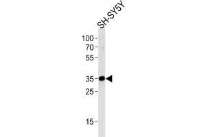 Western Blotting (WB) image for anti-Syntaxin 1B (STX1B) antibody (ABIN3004757)