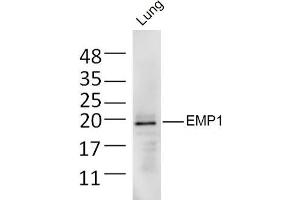 Mouse lung lysates probed with EMP1 Polyclonal Antibody, Unconjugated  at 1:300 dilution and 4˚C overnight incubation. (EMP1 antibody  (AA 101-160))