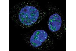 Confocal immunofluorescent analysis of Phospho-Rb- Antibody (ABIN389648 and ABIN2839638) with HepG2 cell followed by Alexa Fluor 488-conjugated goat anti-rabbit lgG (green). (Retinoblastoma 1 antibody  (pSer811))