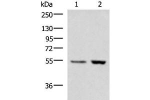 Western blot analysis of Human placenta tissue LOVO cell lysates using ZSWIM1 Polyclonal Antibody at dilution of 1:550 (ZSWIM1 antibody)