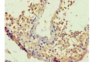 Immunohistochemistry of paraffin-embedded human testis tissue using ABIN7172717 at dilution of 1:100 (BACH1 antibody  (AA 1-320))