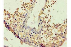 Immunohistochemistry of paraffin-embedded human testis tissue using ABIN7172717 at dilution of 1:100 (BACH1 antibody  (AA 1-320))
