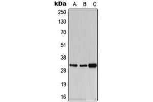 Western blot analysis of PBR expression in HEK293T (A), SP2/0 (B), PC12 (C) whole cell lysates. (TSPO antibody  (C-Term))