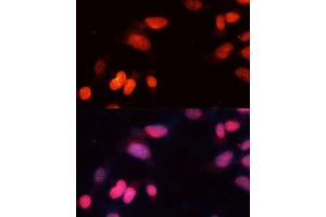 Immunofluorescence analysis of NIH-3T3 cells using SIRT1 Polyclonal Antibody (ABIN3020730, ABIN3020731, ABIN3020732, ABIN1513524 and ABIN6213695) at dilution of 1:100 (40x lens). (SIRT1 antibody)
