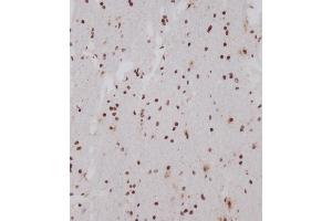 Immunohistochemical analysis of (ABIN1539554 and ABIN2849696) on paraffin-embedded human brain tissue was performed on the Leica®BOND RXm. (OTUD7A antibody  (N-Term))
