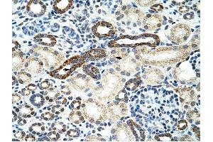 HNRPF antibody was used for immunohistochemistry at a concentration of 4-8 ug/ml to stain Epithelial cells of renal tubule (arrows!