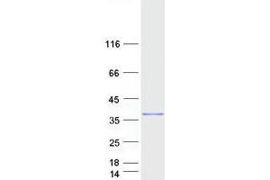 Validation with Western Blot